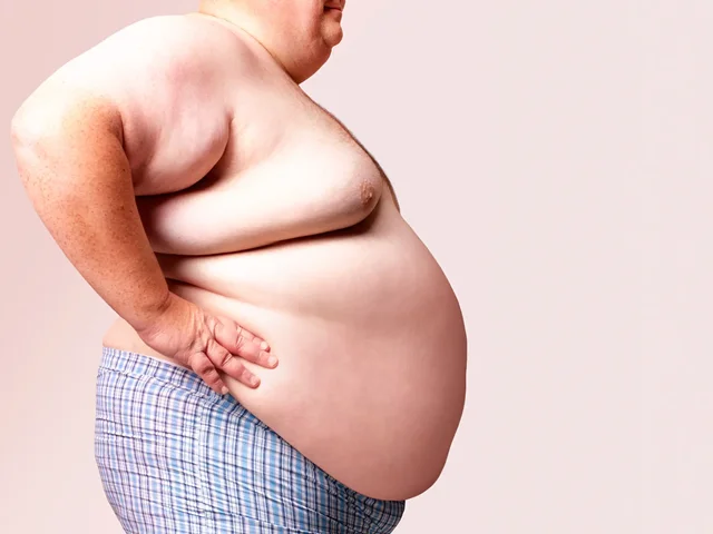 ۵ عارضه ی چاقی که می تواند جان شما را تهدید کند